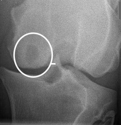 developmental joint disease in a young horse